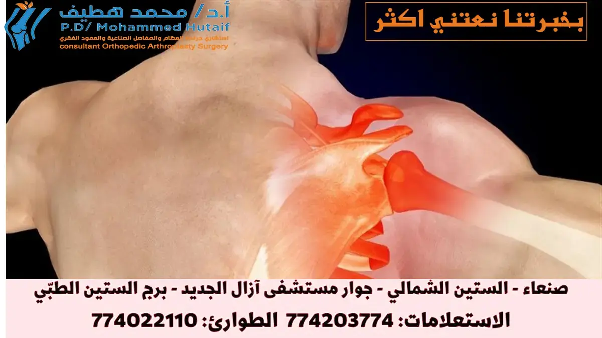 التئام الكسور: اكتشف أسرار الشفاء السريع والعلاج الفعال