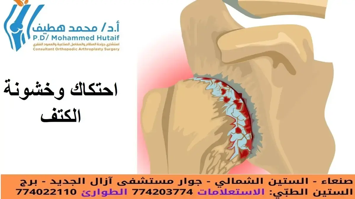 اكتشف اسرار الام الكتف: دليلك لتشخيص وعلاج أوجاعه بفاعلية