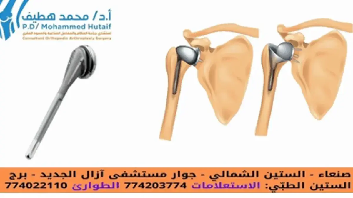 اكتشف خبايا تشريح الكتف: دليل شامل لأسرار العظام والمفاصل.