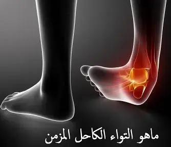 إليك بعض الخيارات، مع الأخذ في الاعتبار المتطلبات الإبداعية والتقنية:*   **وداعًا للتكاليف الباهظة: حلول طبية "Cost 1" بين يديك!** (45 حرف)*   **اكتشف "Cost 1": رعاية طبية عالية الجودة بتكلفة معقولة** (48 حرف)*   **دليلك إلى "Cost 1": أفضل الخيارات الطبية بأسعار لا تقبل المنافسة** (55 حرف)*   **"Cost 1": ثورة في عالم الرعاية الصحية.. بأسعار في متناول الجميع!** (55 حرف)*   **تعرف على "Cost 1": مستقبل الرعاية الطبية الميسرة للجميع!** (46 حرف)*   **"Cost 1": صحتك أولاً.. ورعايتك الطبية في متناول يدك!** (46 حرف)*   **"Cost 1": الرعاية الصحية الموثوقة التي تستحقها.. بتكلفة أقل!** (49 حرف)**شرح الخيارات:***   كل خ