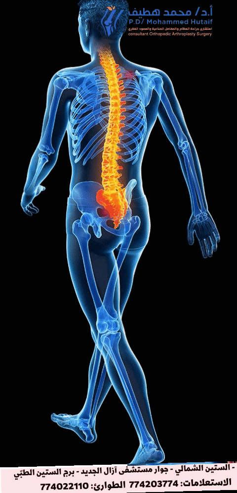 اعرف اني اعاني من عرق النسا: دليلك لأعراضه المؤكدة الآن