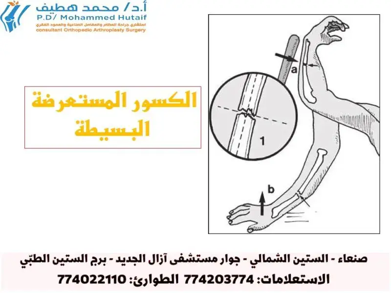 اكتشف: علاج قرح القدم السكري وأسبابه وأعراضه