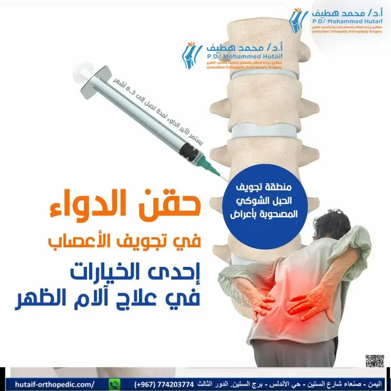 صورة توضيحية لعملية إيثاق مفصل الركبة باستخدام المسمار النخاعي بعد فشل المفصل الصناعي