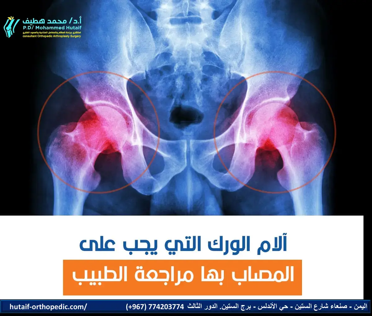 دليل شامل: حماية طفلك من الإعاقة بالتهاب المفاصل الانتاني
