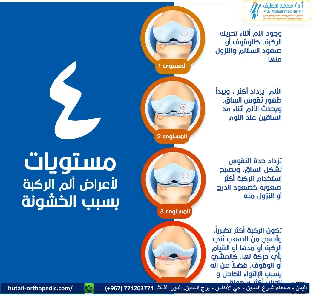 اكتشف: أسباب سقوط القدم، الأعراض و العلاج الفعال!