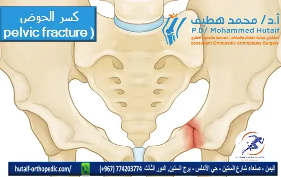 اكتشف: خلع مفصل الورك الخلفي.. دليلك الشامل!