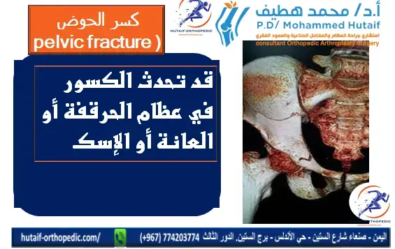 دليلك الشامل: جراحة الكتف.. تقنيات حديثة لنتائج أفضل!