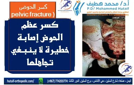 الطعم العظمي الخيفي: حلول متقدمة لفقدان عظم الفخذ الشديد.