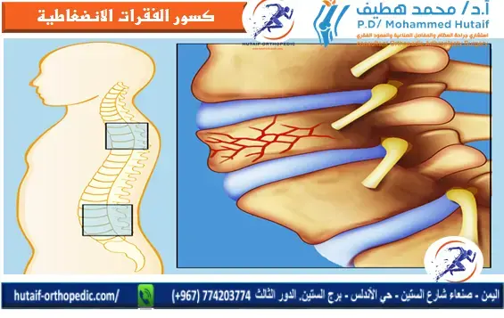 ركبة العدّاء: دليلك الشامل لعودة سريعة وقوية بلا ألم