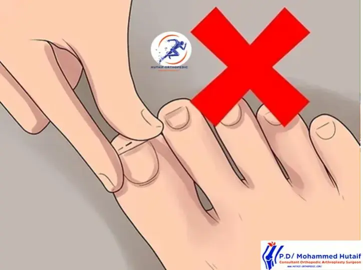 اكتشف مخاطر تنظير مفصل الكتف: دليل شامل لتجنبها