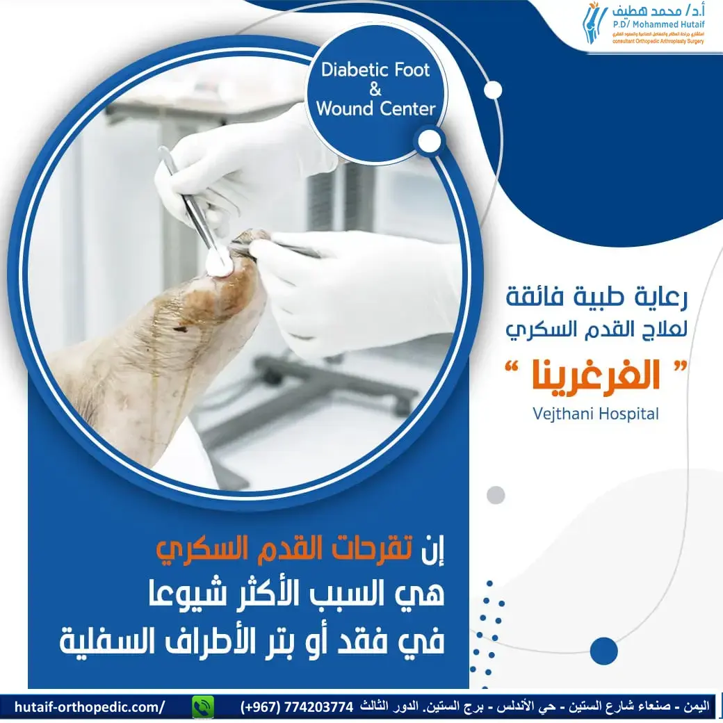 أتقن خلع الورك الخلقي: بنك MCQs لأطباء العظام بالبورد