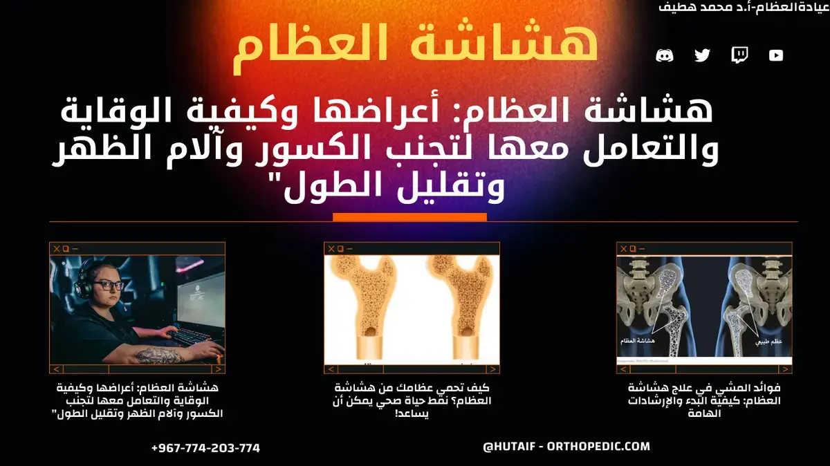 كسر هولشتاين-لويس بشلل العصب الكعبري: دليل تعافيك الأمثل