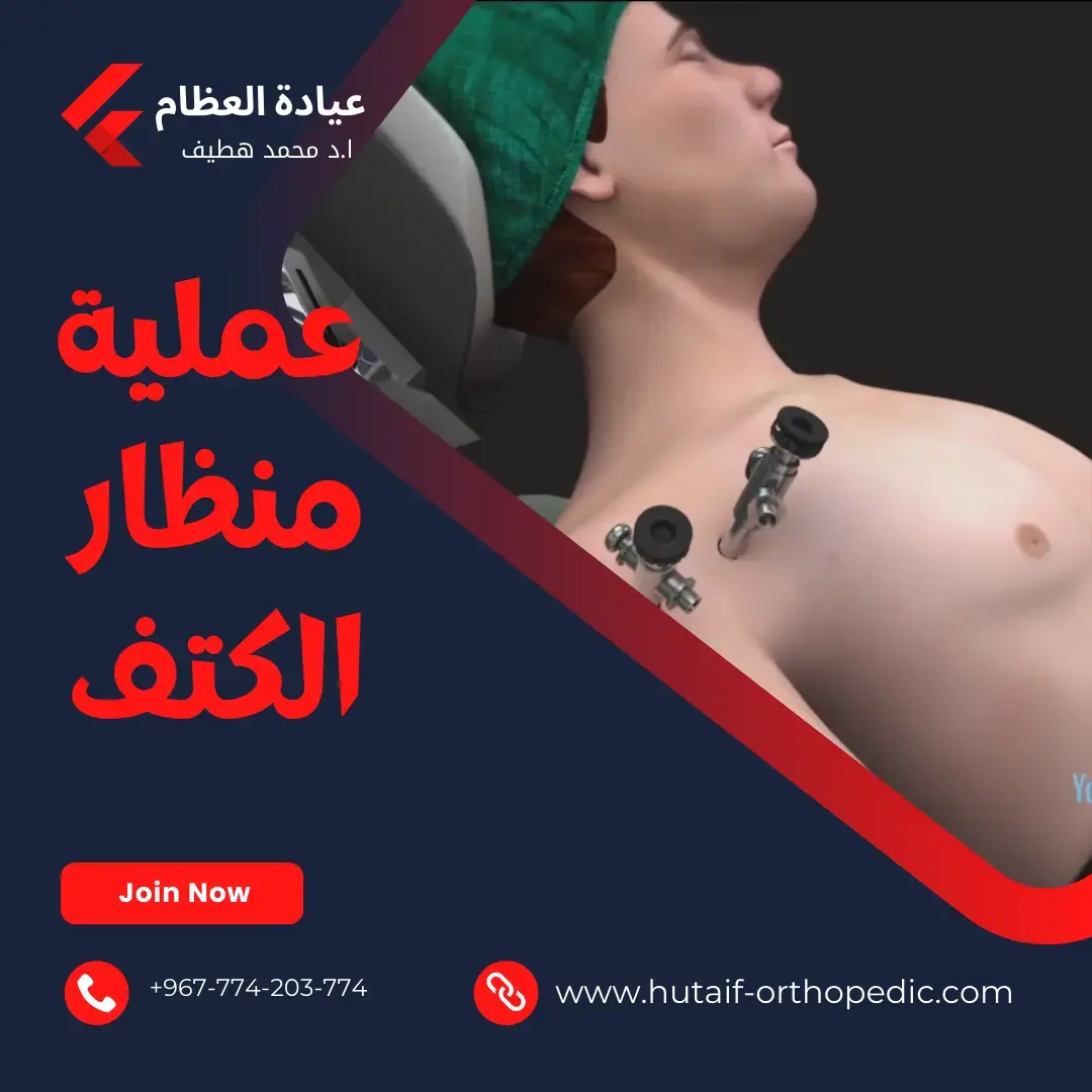 اكتشف سر المفصل غير المثبت: تقنيات جراحية مبتكرة