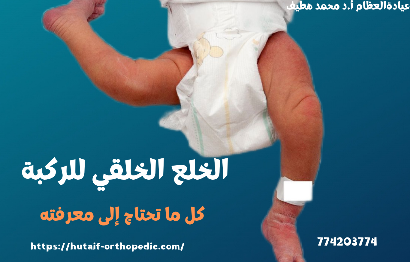 الدليل الشامل لركبة العدائين: الأسباب، الأعراض، العلاج والوقاية