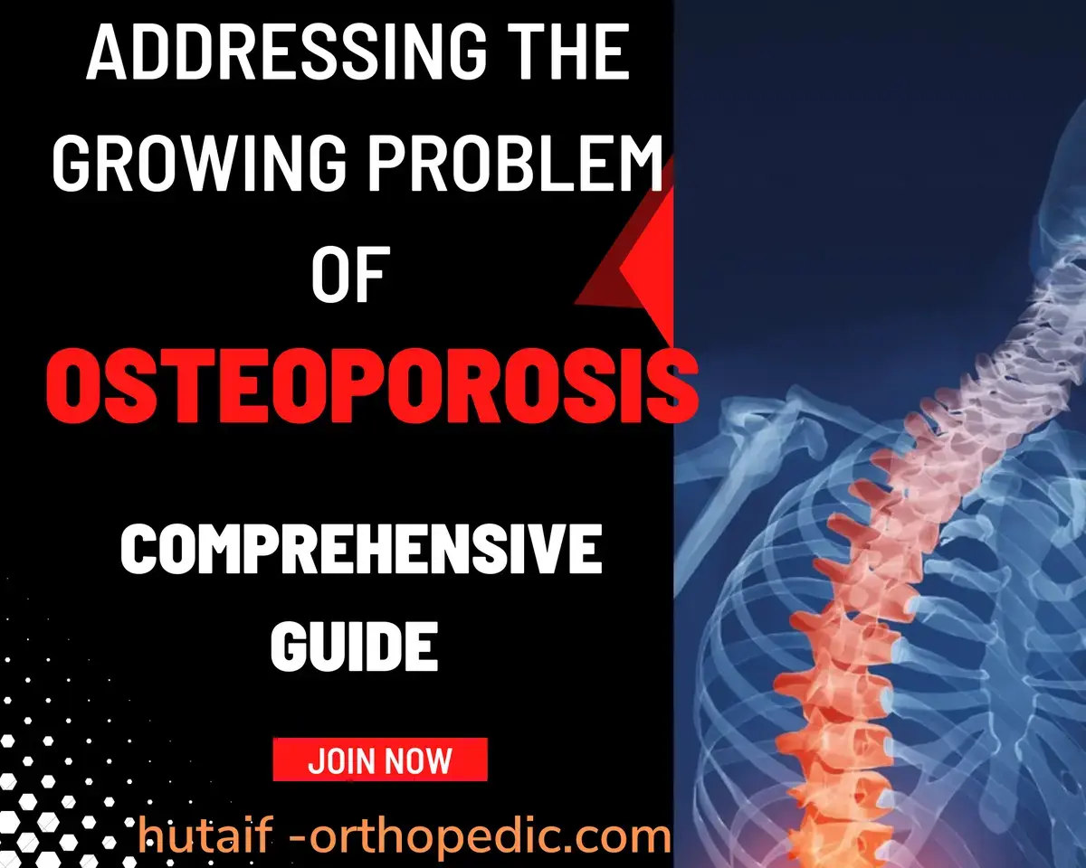 اكتشف خبايا كسر الزورقي: تشخيص دقيق وخيارات علاج مبتكرة