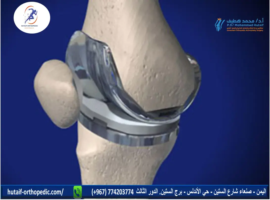 اكتشف أسرار تشريح الذراع والمرفق: فهم عميق لوظائفهما وحركتهما