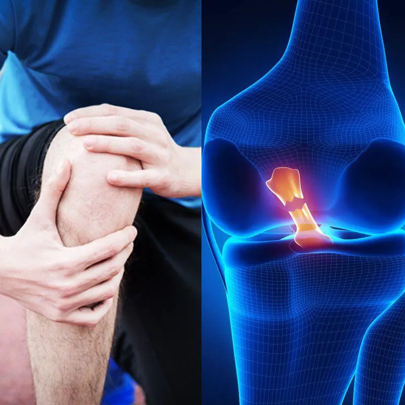 أفضل دكتور عظام أطفال في اليمن وصنعاء: البروفيسور محمد هطيف | الدليل الشامل 2026