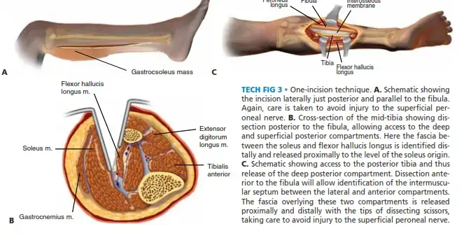 نموذج حجز المرضي لعيادة العظام: دليلك الشامل لراحة المرضى