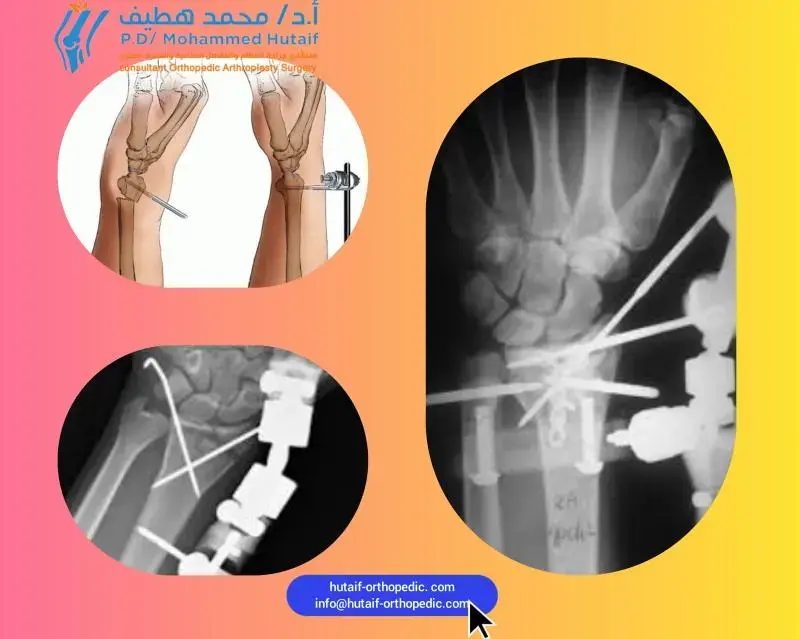 اكتشف قوة جدول s3: دليل شامل لصحة العظام