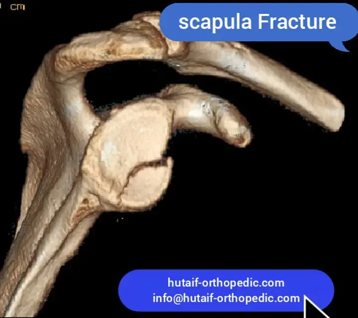 اكتشف قوة منظار الورك: علاج فعال لأمراض غير هيكلية