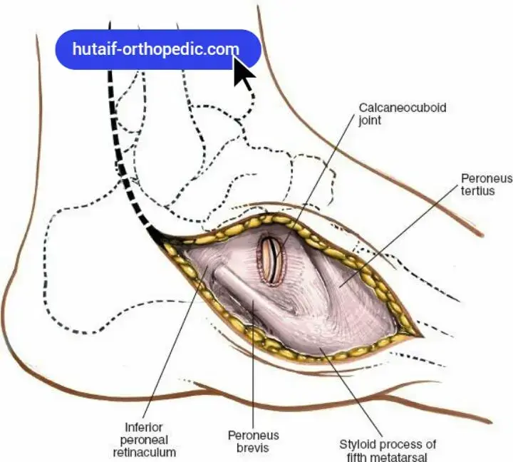 ودّع آلام المفاصل: الرياضة سر عظام قوية لصحة العظام والمفاصل