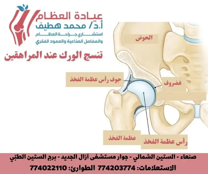 زرعات التيتانيوم المخددة: حلول مبتكرة في جراحة استبدال مفصل الورك المعقدة