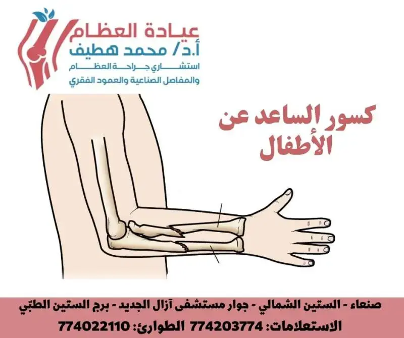 استعد لـ FRCS: إتقان البراغي العظمية لنجاحك في امتحان الزمالة