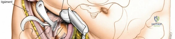 Clinical Image