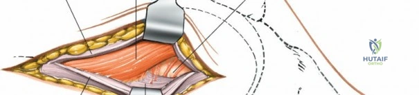 Clinical Image