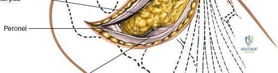 Clinical Image