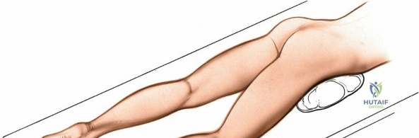 Clinical Image