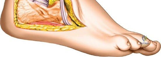 Clinical Image