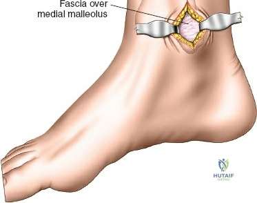 Clinical Image