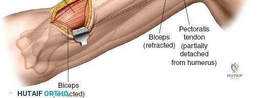 Clinical Image