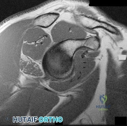دليلك الشامل للوقاية من السقوط في المنزل: نصائح الأستاذ الدكتور محمد هطيف لسلامة أسرتك في صنعاء