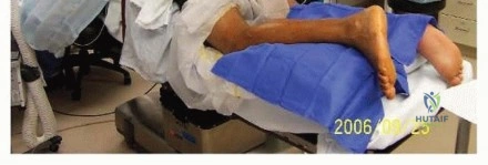 Illustration of repair and early - Dr. Mohammed Hutaif
