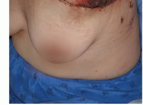 تفاصيل مرئية 50 - بتر الربع الأمامي: كل ما يجب أن تعرفه عن هذا الإجراء المعقد