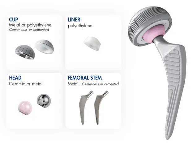 مراحل عملية تبديل مفصل الورك