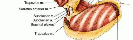 تفاصيل مرئية 34 - بتر الربع الأمامي: كل ما يجب أن تعرفه عن هذا الإجراء المعقد
