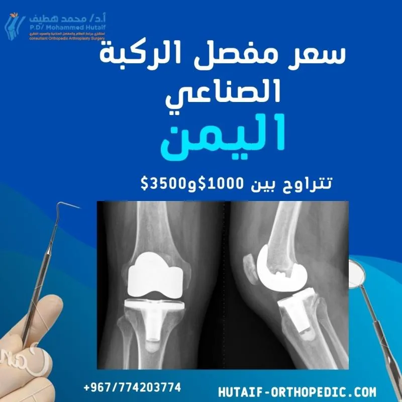 رسوم توضيحية لعملية تنظير الركبة، تظهر الأدوات المستخدمة في الجراحة