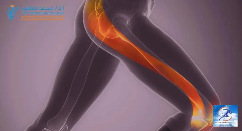 مريض يقوم بتمارين علاج طبيعي لتقوية الركبة، يوضح العلاج التحفظي