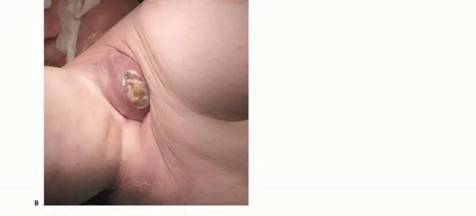 تفاصيل مرئية 6 - بتر الربع الأمامي: كل ما يجب أن تعرفه عن هذا الإجراء المعقد