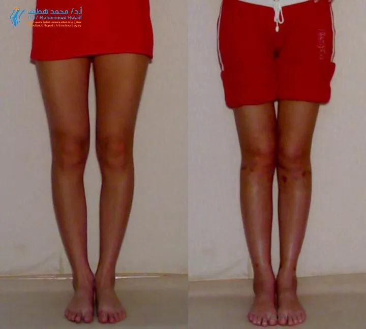 الأستاذ الدكتور محمد هطيف يصافح مريضاً في عيادته