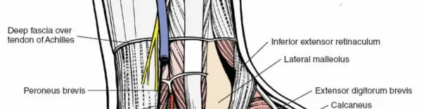 صورة من عملية جراحية للقدم