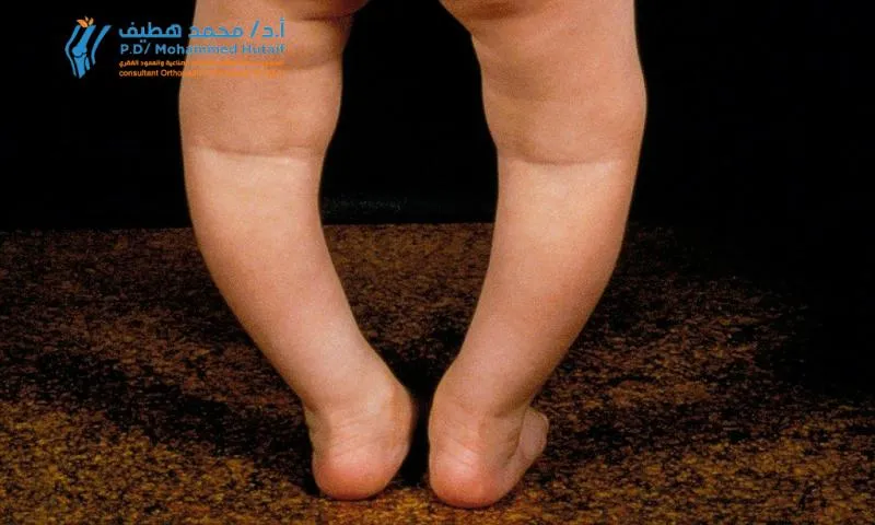 معالج طبيعي يوجه مريضاً في تمارين تقوية الركبة