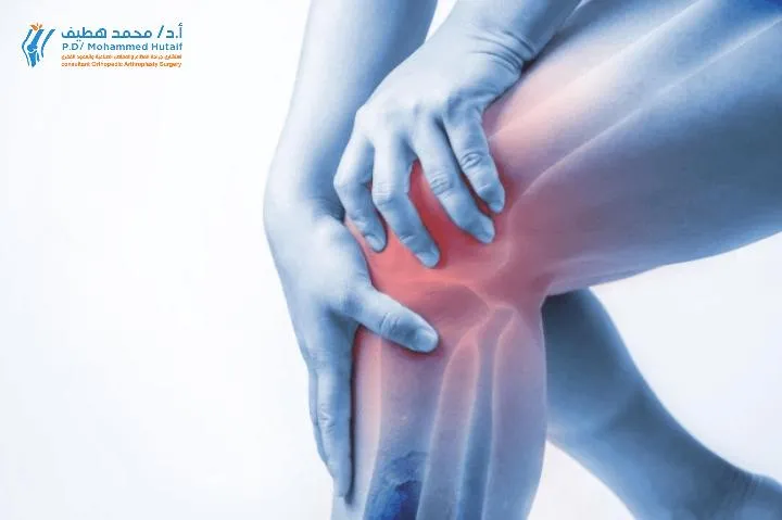 أخصائي تقويم يفحص ركبة المريض، يوضح عملية التشخيص الدقيق