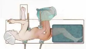 تفاصيل مرئية 19 - الفخذي المنعطف الانسي: ركيزة أمانك في خلع الورك الجراحي