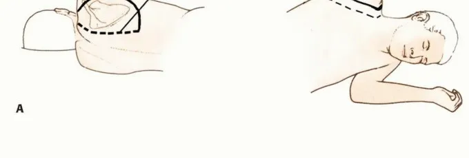 تفاصيل مرئية 12 - بتر الربع الأمامي: كل ما يجب أن تعرفه عن هذا الإجراء المعقد