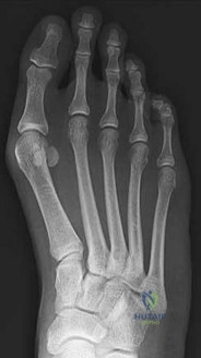 Orthopedic Surgery Board Review MCQs: AAOS Master Bank Part 1