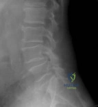 Orthopedic Surgery Board Review MCQs: AAOS Master Bank Part 147